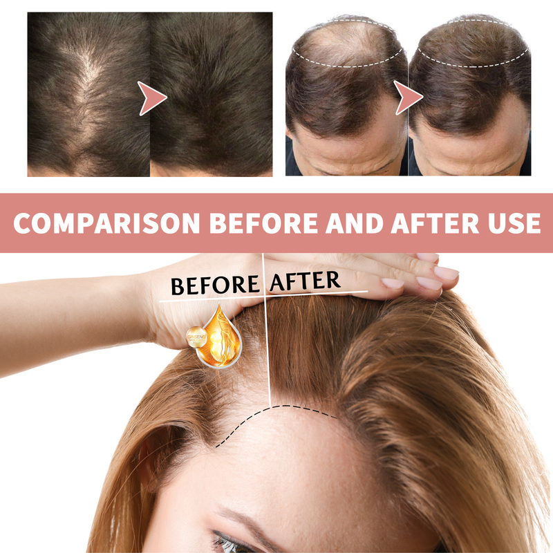 EELHOE Fiala per capelli spessi Cura dei capelli spessi e forti Riparazione dei capelli del cuoio capelluto Massaggio rassodante anticaduta della radice dei capelli_voghion.com