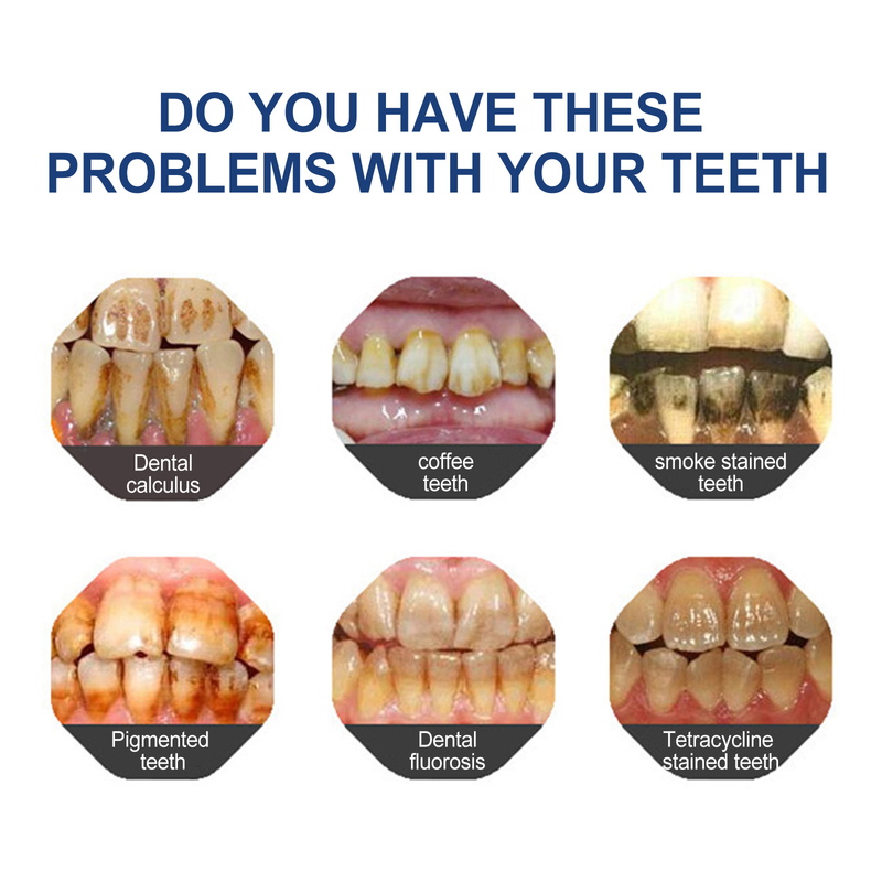 Zobu balināšana Jaysuing baltā krāsa notīra traipus un netīrumus uz zobiem Balto zobu izgaismošana Dzelteni mutes zobi_voghion.com