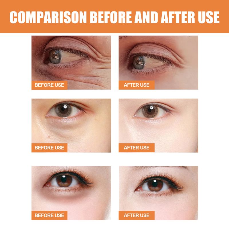 Vitamina C ochi cremă stick antirid balsam hidratant ochi pungi îndepărtarea cearcănelor reduce liniile fine anti umflarea ochilor crema_voghion.com