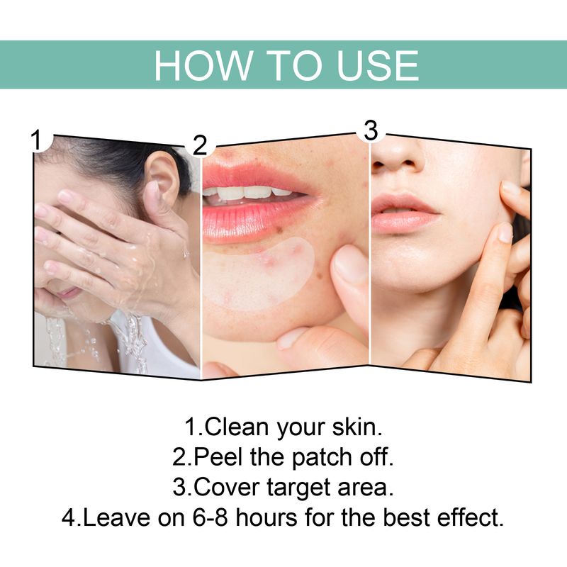 EELHOE Facial Mask Mild And Non Irritating Print Healing Acne Facial Repair Patch_voghion.com