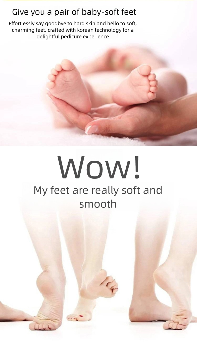 Neu Elektrische Datei Pediküre Stein Ferse Hause Fuß Wäscher Kallus Remover_voghion.com