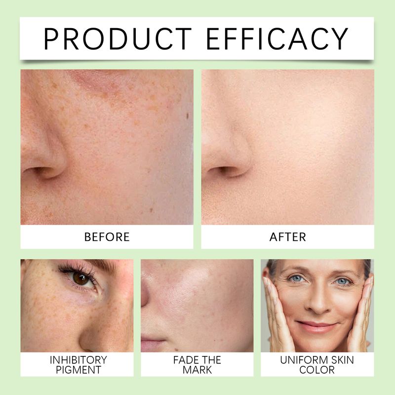 HANCHOBIT Propolis Nicotinamide Serum Hydrating, Moisturizing, Mild, Moisturizing, Nourishing And Tender Skin Essence_voghion.com