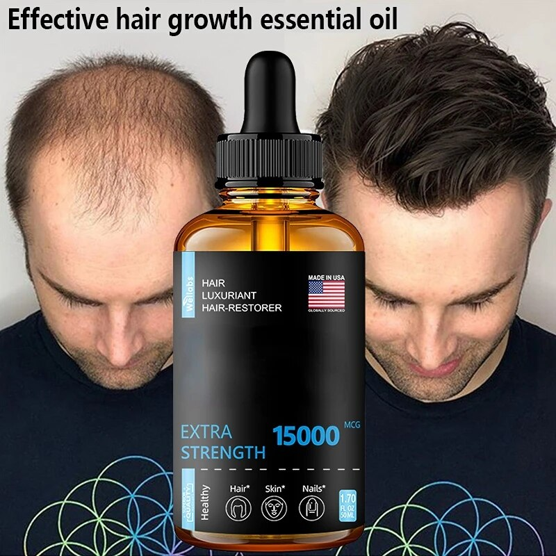 Hårtillväxt Eteriska oljor Produkter Ingefära Essens Snabb återväxt Serum Skäggtillväxtolja Håravfallsvård Skönhetsbehandling av hårbotten_voghion.com