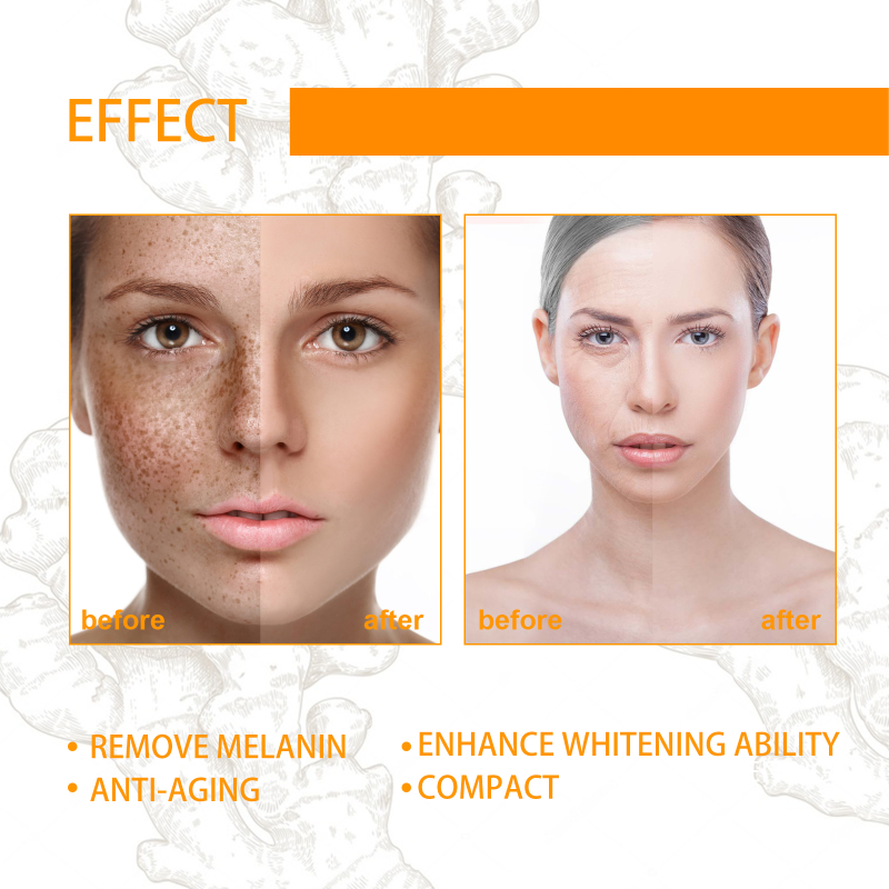Whitening Freckle 1 STK Serum Brighten Fjern mørk plet Fade Pigment Melanin Korrigerende Facial Essence Hudpleje Kor_voghion.com