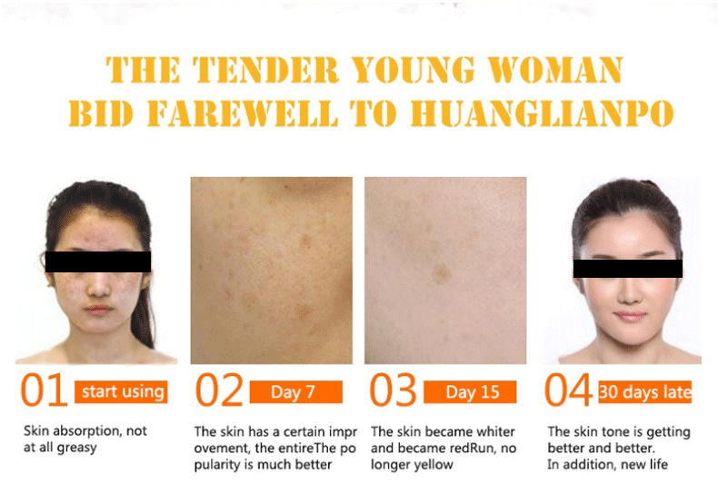 Vitamine C Serum Hyaluronzuur Whitening Anti-Aging Vervagen Vlekken Verwijderen Sproet Anti Alikruiken Hydraterende Gezichtscrème Zorg_voghion.com