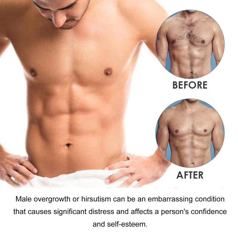 2024 Men's Hair Removal Cream is gentle non irritating, cleansing rejuvenating all over the arms, armpits, legs,_voghion.com