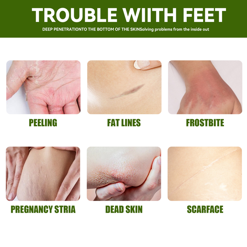 EELHOE Urea Hand and Foot Cream Nawilżający, przeciw wysuszaniu, nawilżający, regenerujący, wielofunkcyjny krem do rąk i stóp_voghion.com
