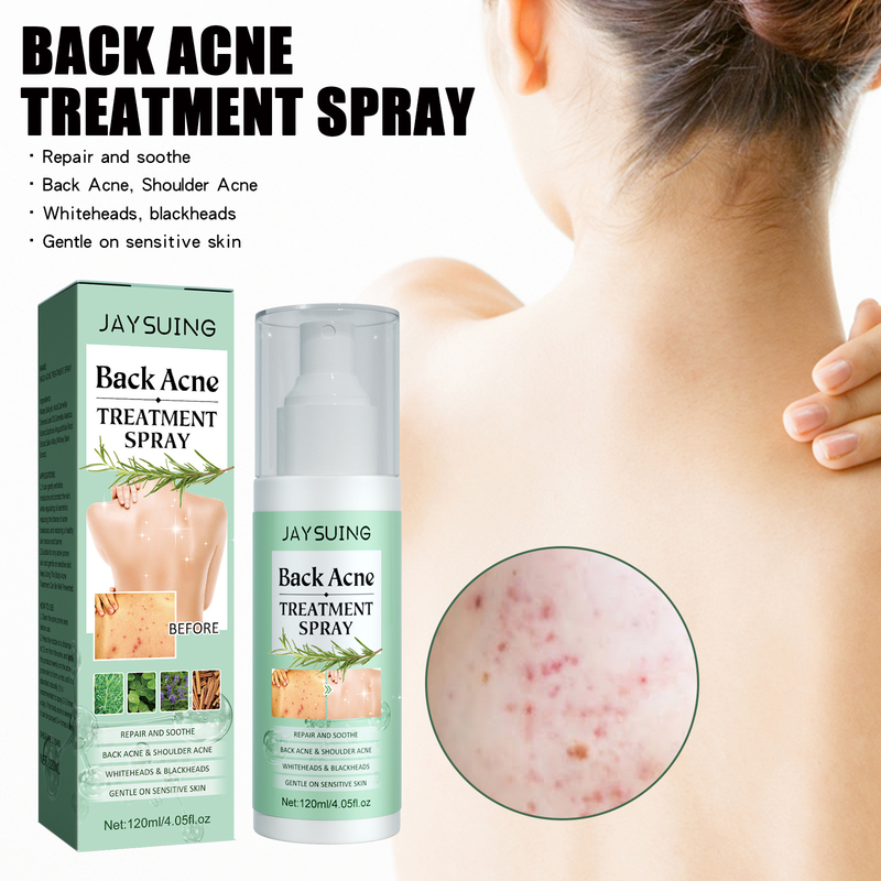 Jayswing back spray to fade acne marks, repair back, shoulder, body, clean and smooth skin_voghion.com