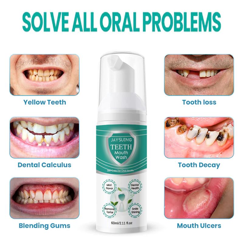 Pena za čiščenje zob 2024 24ss globinsko očisti zobne madeže, zaščiti dlesni in osveži dah_voghion.com