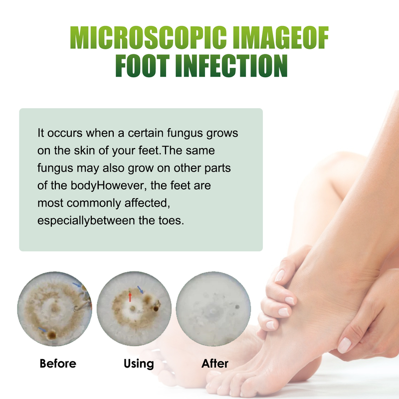 Pflege Schöne fuß spray desodorierende fuß geruch bakteriostase antipruritic fuß juckreiz schweiß fuß pflege_voghion.com