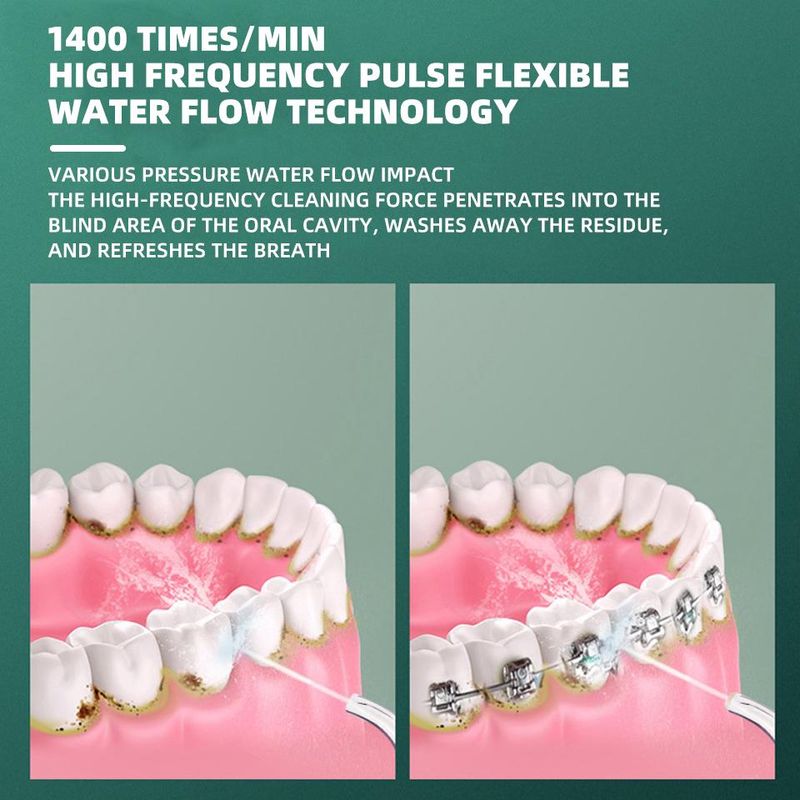 Elektrisk tannrenser Oral Irrigator Oppladbar Vannstråle Tannrenser Tannvannstråd Tannrenser LXY_voghion.com