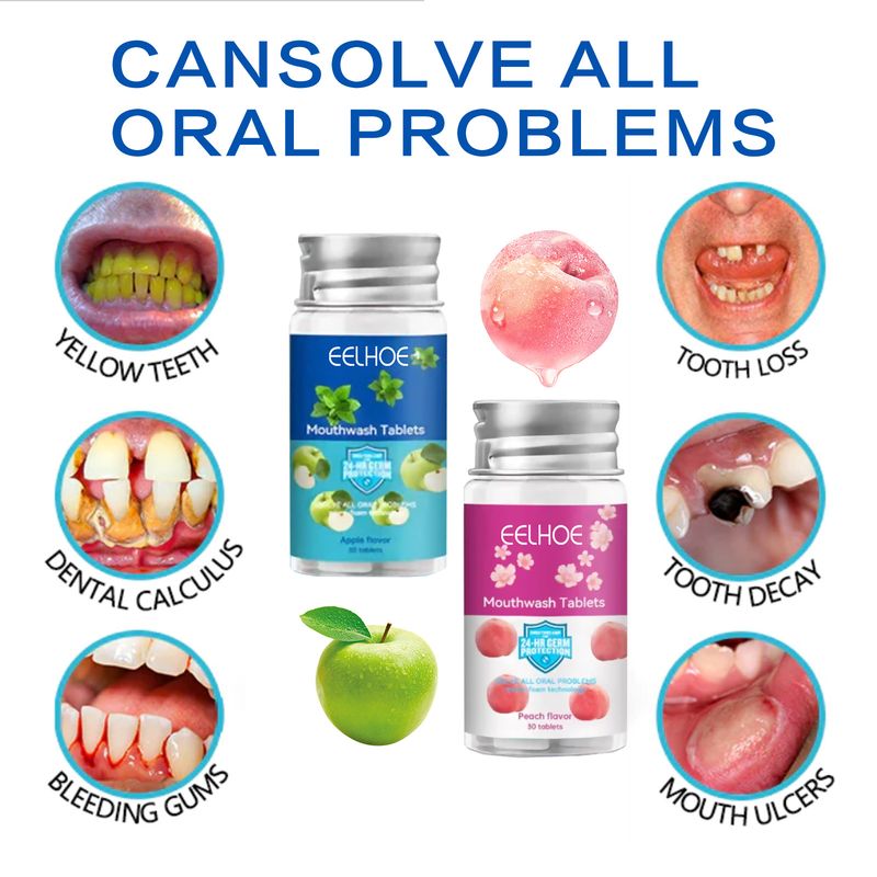 Aufhellende Zahnpasta-Tabletten, Reinigung der Zähne, Behandlung von Mundgeruch, frischer Atem, Entfernung von Zahnflecken, tragbare Mundwasser-Tabletten_voghion.com