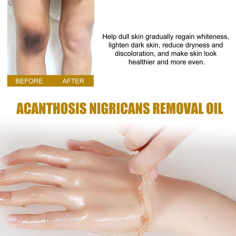 Back Thorny Exfoiating Oi, Underarm, Knee, Ebow Joint Backift, Brightening Skin Tone and Beauty_voghion.com