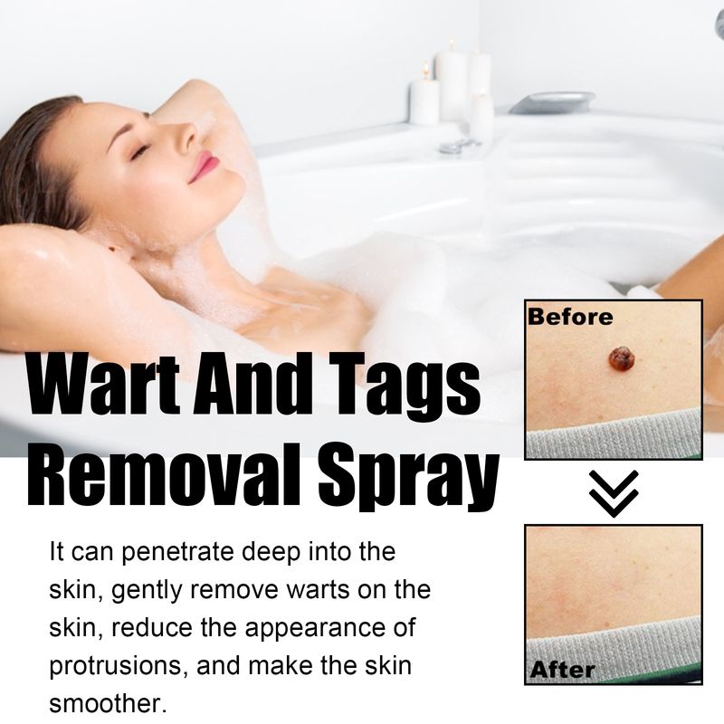 Spray Ximonth pentru îndepărtarea negilor și a alunițelor, curăță și estompează alunițele, spray reparator neted pentru piele_voghion.com