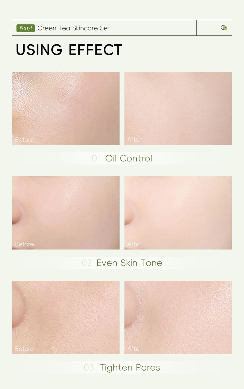 Peelings & Körperbehandlungen – Neues 5-teiliges Set mit grünem Tee: Waschlotion 50 g + Wasser 100 ml + Creme 25 g + Augencreme 15 g + Essenz 17 ml_voghion.com
