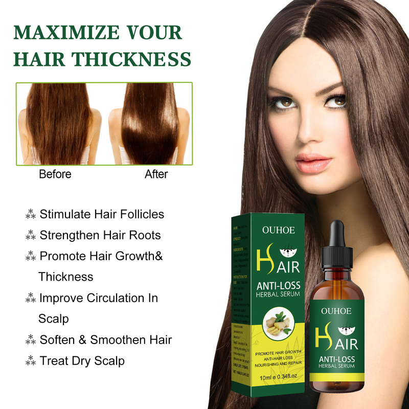Olio OUHOE Essenziale Ammorbidente Cura Radice Densa Anti Caduta Forte Essenza per Capelli_voghion.com