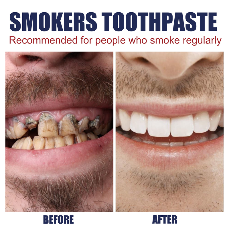 Dentifrice EELHOE pour éliminer les taches de smog, éliminer les taches de dents jaunes, nettoyer les dents, blanchir et rafraîchir le dentifrice pour soins bucco-dentaires_voghion.com
