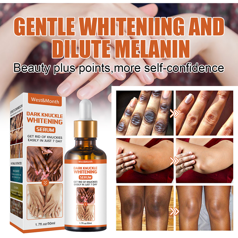 50ml Whitening Serum 7 Days Remover Get Rid Of Dark Knees Dark Knuckle Elbow Cream Nicotinamide Brighten Skin Tone 2023 New_voghion.com