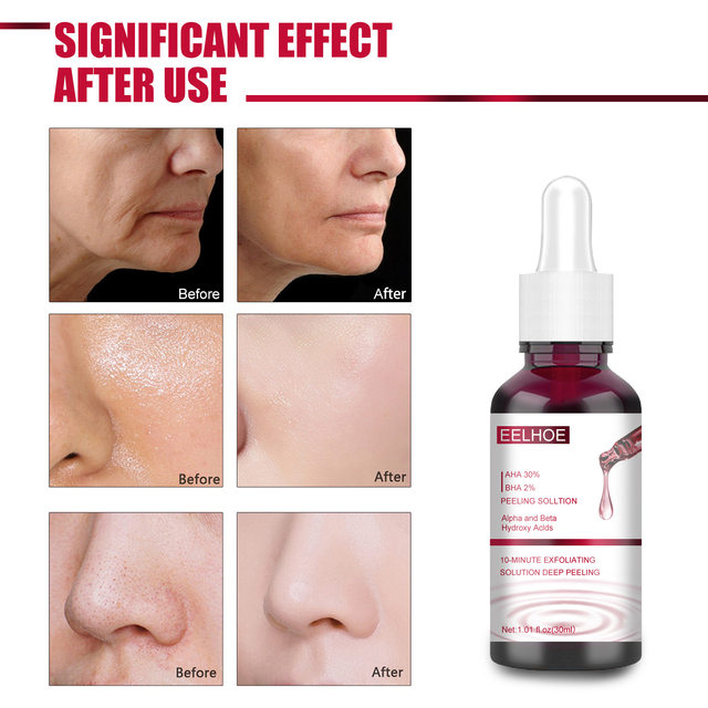 Pore Shrinking Serum Salisylsyre Frukt Acid Essence Glatte porer Anti Aldring Bghten Whitening Fuktighetsgivende hudpleieprodukt 30ml_voghion.com
