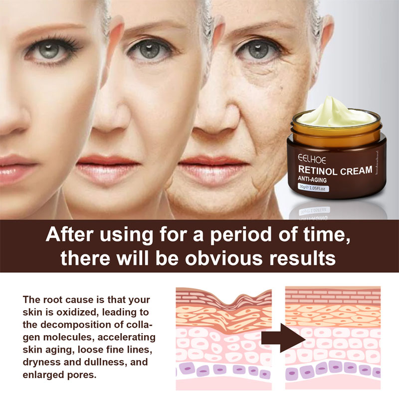 Rynkefjerner Retinol Ansigtscreme Anti-aging Falmende Fine Linjer Hudpleje Hyaluronsyre Fugtgivende Glat Koreansk B_voghion.com