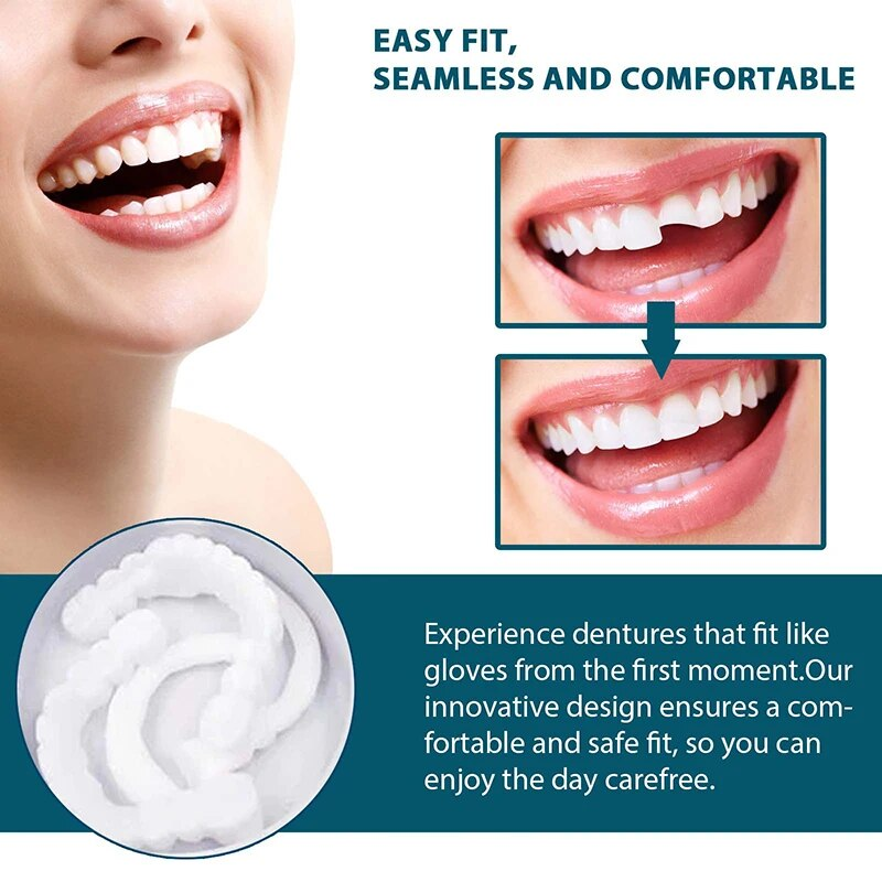 Set regolabile Impiallacciatura sorridente istantanea Sbiancamento denti per protesi Decora gli spazi tra i denti_voghion.com