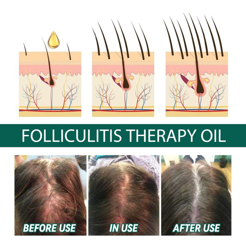 Suero de aceite capilar fortalecedor, suave, sedoso, para cabello débil, más grueso y abundante, tratamiento nutritivo para el cuero cabelludo para hombres y mujeres, productos para el cuidado del cabello._voghion.com