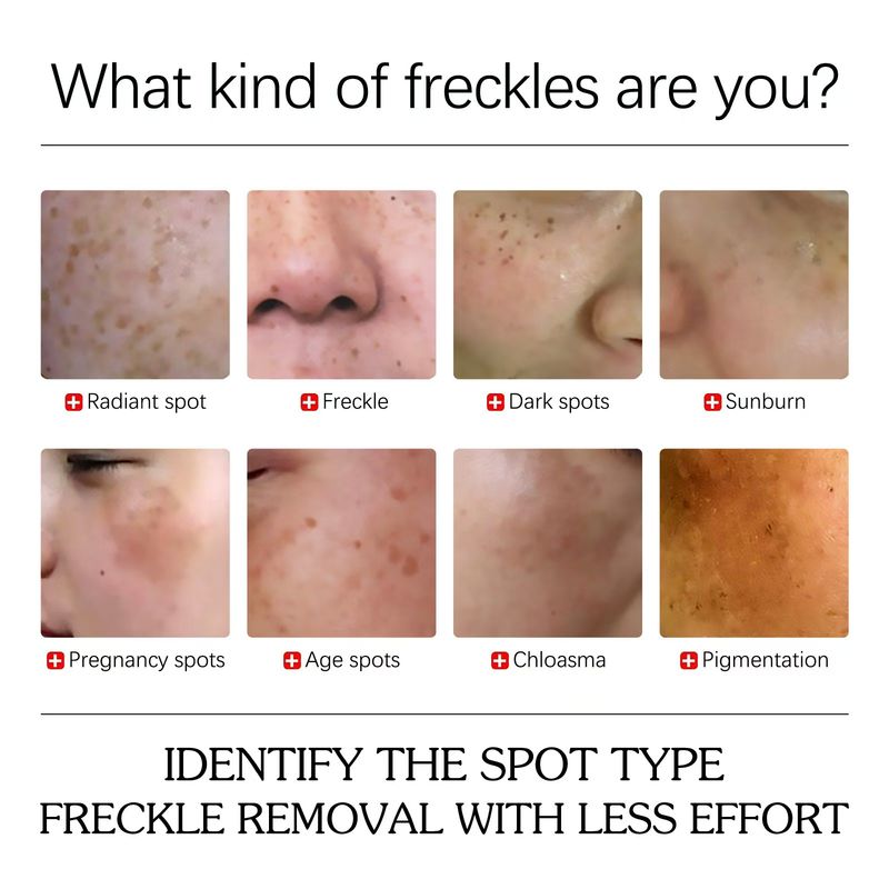 Curcumic acid can effectively fade and remove dark spots on the face essence oil_voghion.com