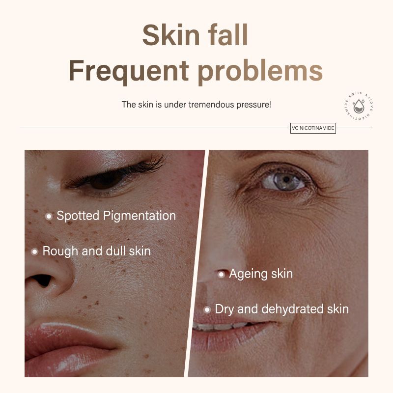 Vitamin C Kojic Acid Nicotinamide Essence Pure English Packaging Facial VC Original Solution_voghion.com