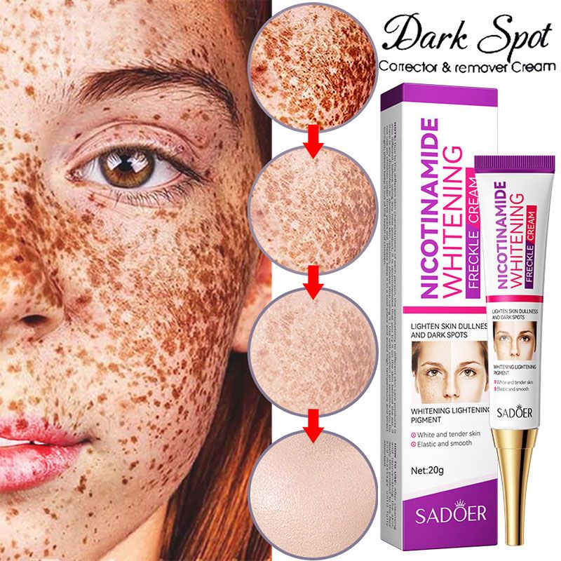 Nikotinamid Hvidningscreme til fjernelse af fregner Fjerner effektivt melasma Mørke pletter Aknemærker Lysner melanin Ansigtshudpleje_voghion.com
