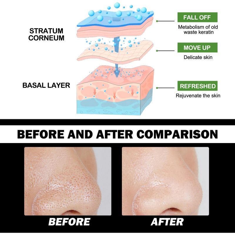Crème pour enlever les points noirs du nez, bandes nasales exfoliantes, nettoyage en profondeur, rétrécissement des pores, points noirs du nez, autocollants pour enlever les points noirs, soins de la peau, maquillage_voghion.com