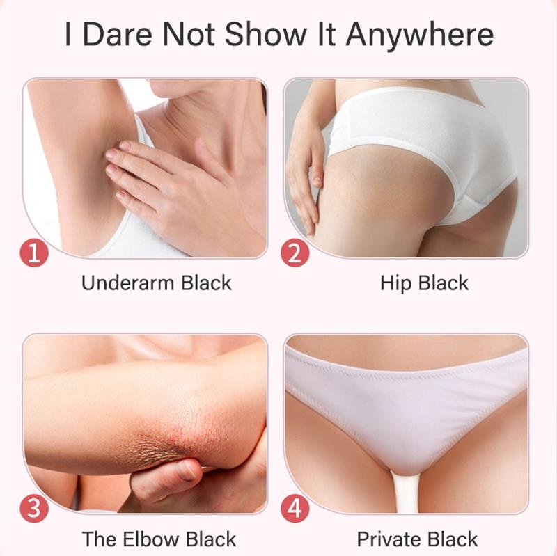 Seife Kierper Whitening Ënneraarm Knéi Hënner Däischter Haut Bleech Verbesserung Melanin Pigmentatioun Dull Moisturizing Brighten_voghion.com