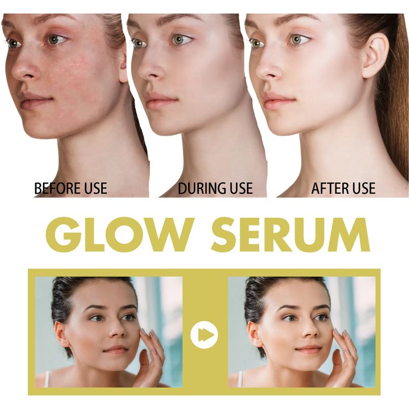 Hoygi Glow Serum, Moisturizing And Whitening Skin To Reduce Facial Spots And Fine Lines_voghion.com