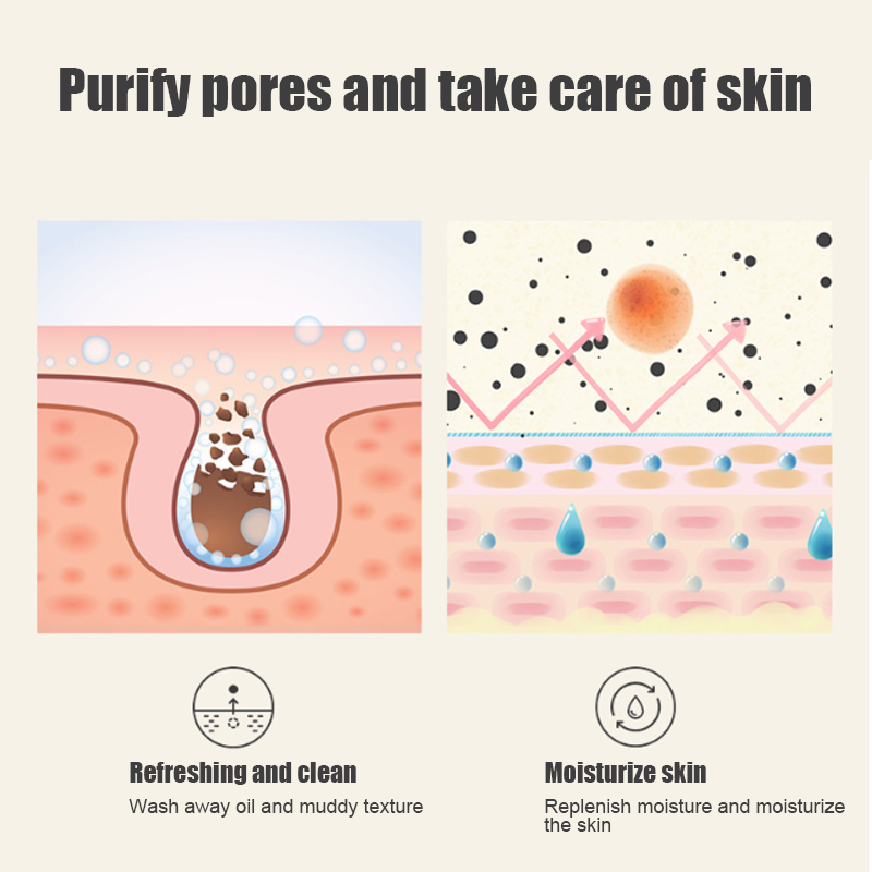 Seife Kierper Whitening Ënneraarm Knéi Hënner Däischter Haut Bleech Verbesserung Melanin Pigmentatioun Dull Moisturizing Brighten_voghion.com