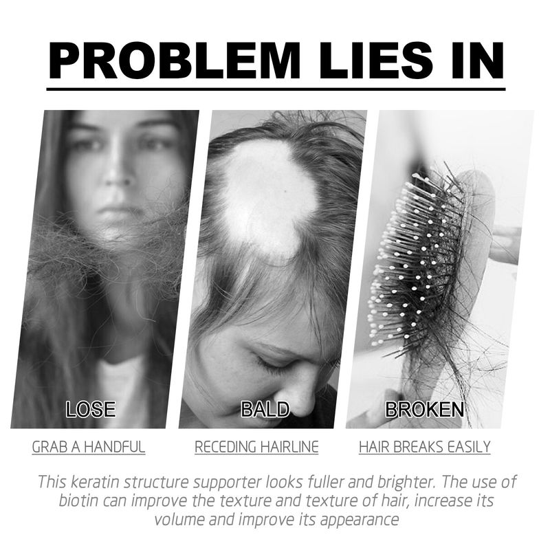 25ss Óleo Essencial de Massagem Nutricional para Hidratação e Cura, Suavizante e Nutritivo para Cabelos_voghion.com