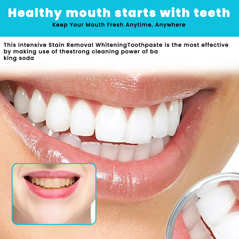 Teeth OUHOE Whitening Mousse Cleansing Tooth Stain Refreshing Breath, Anti Cavity Care, Gingival Care, Toothpaste, paste,_voghion.com