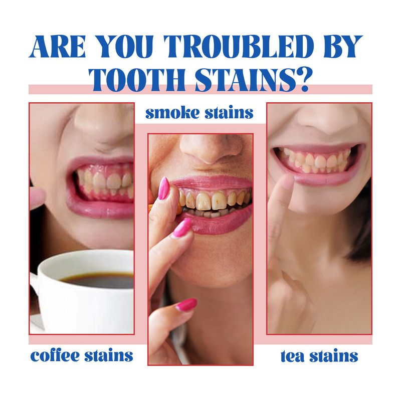 Dentifrice probiotique, dentifrice nettoyant et parfumé pour les soins dentaires_voghion.com