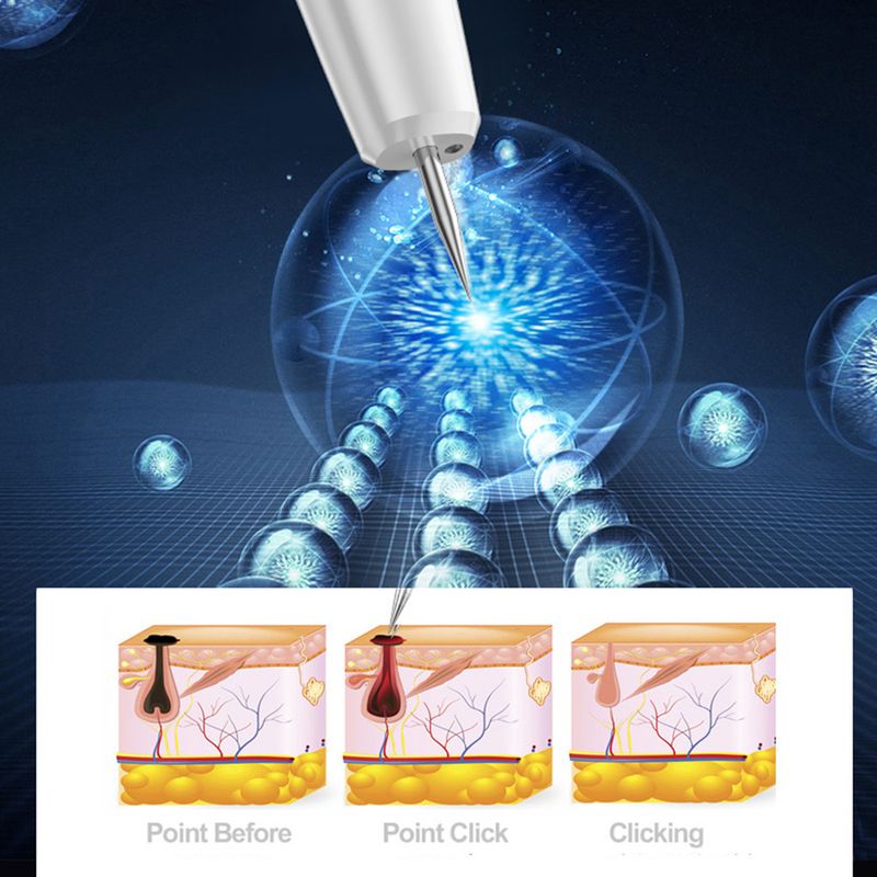 New 15 grade beauty for removing moles, warts, and freckles. Home mole scanning pen with LED display lighting_voghion.com