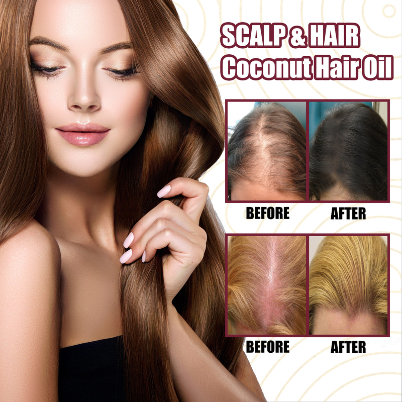 Olio essenziale di cipolla OUHOE Spray per capelli resistente, sodo, idratante, bello e denso_voghion.com