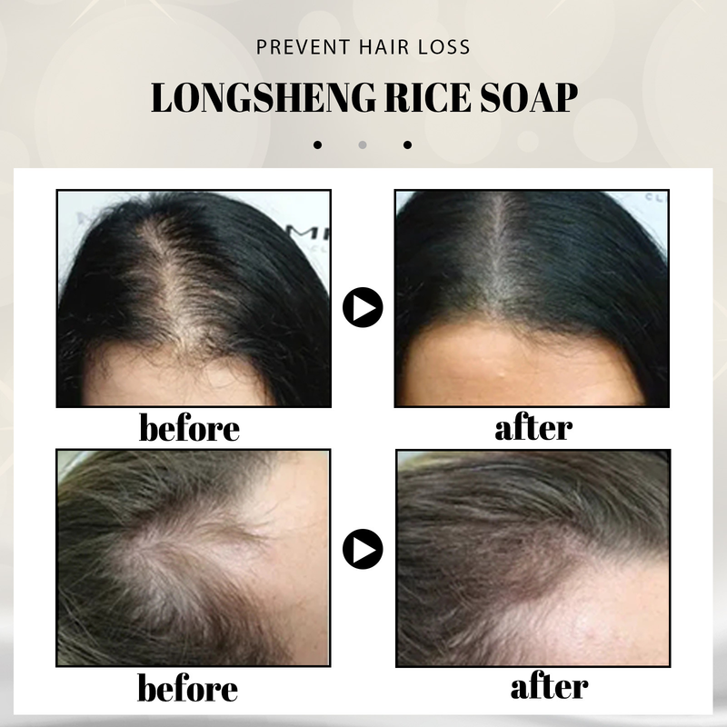 Rice Beautiful Longsheng Wasser-Shampoo-Seife, Blumen-Seife, Shampoo, nährende Haarpflege, Haar-Fury-Pflegeseife_voghion.com