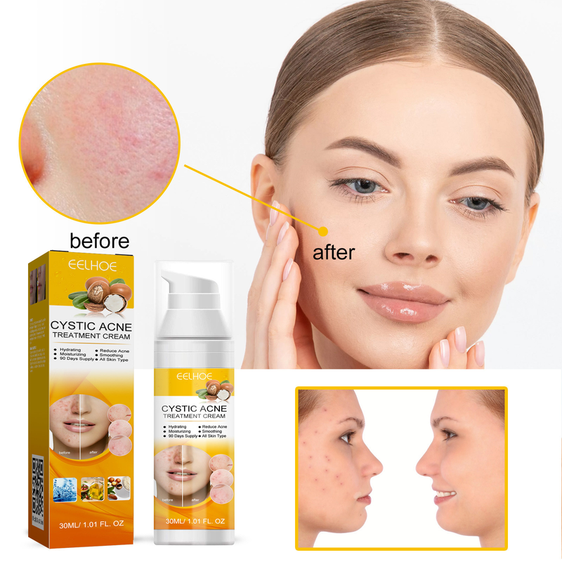 EELHOE Facial Skin Care Cleansing&Reducing Spots, Eliminating Acne and Shrinking Pore essence_voghion.com