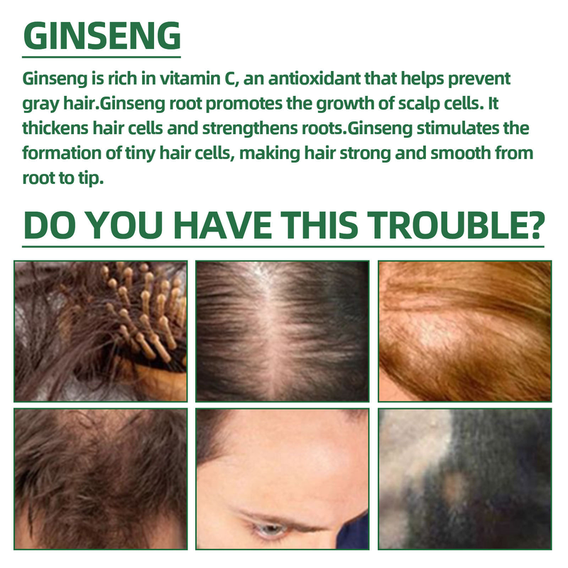 Ginseng OUHOE Lotion essence Moisturizes Hair, Prevents Loss, Fixes Hair and spray_voghion.com