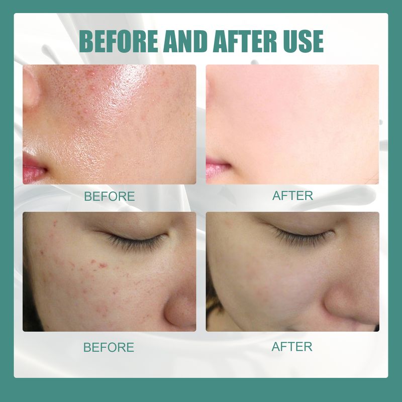 EELHOE Silk Protein Mask Soap (Square Version) Deeply Cleanses And Repairs The Skin, Moisturizes And Rejuvenates The Skin. Silk Goat Milk Cleansing Soap_voghion.com