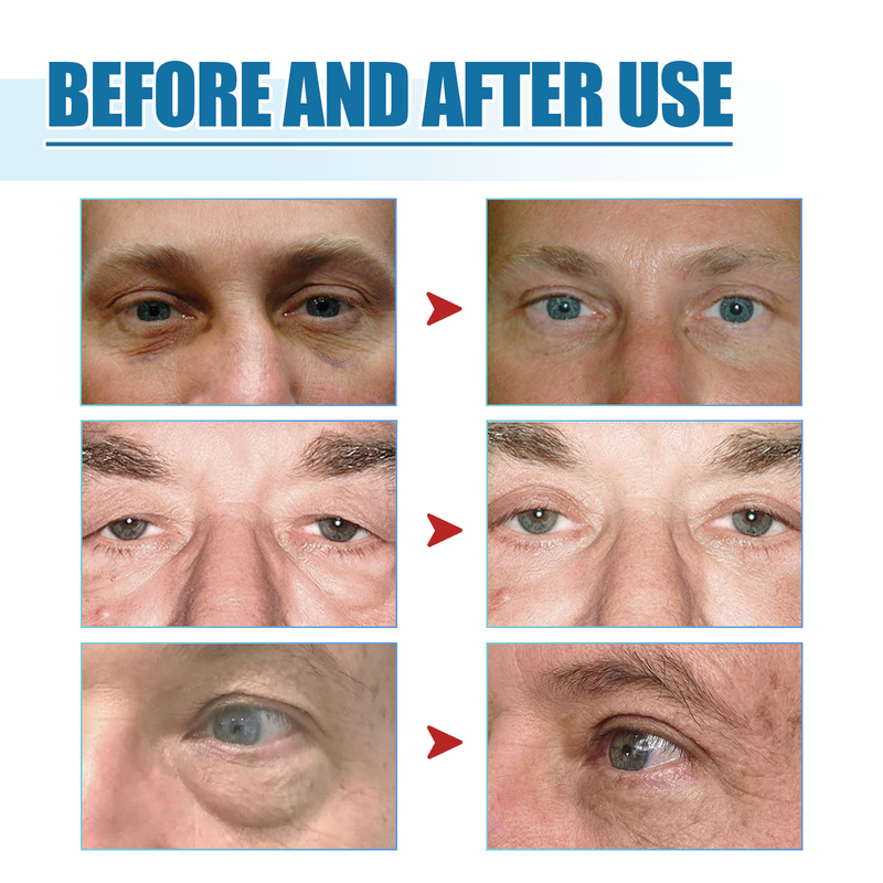 men's eye Beautiful essence reduces fine lines around the eyes, moisturizes and tightens the skin around the eyes s, s_voghion.com