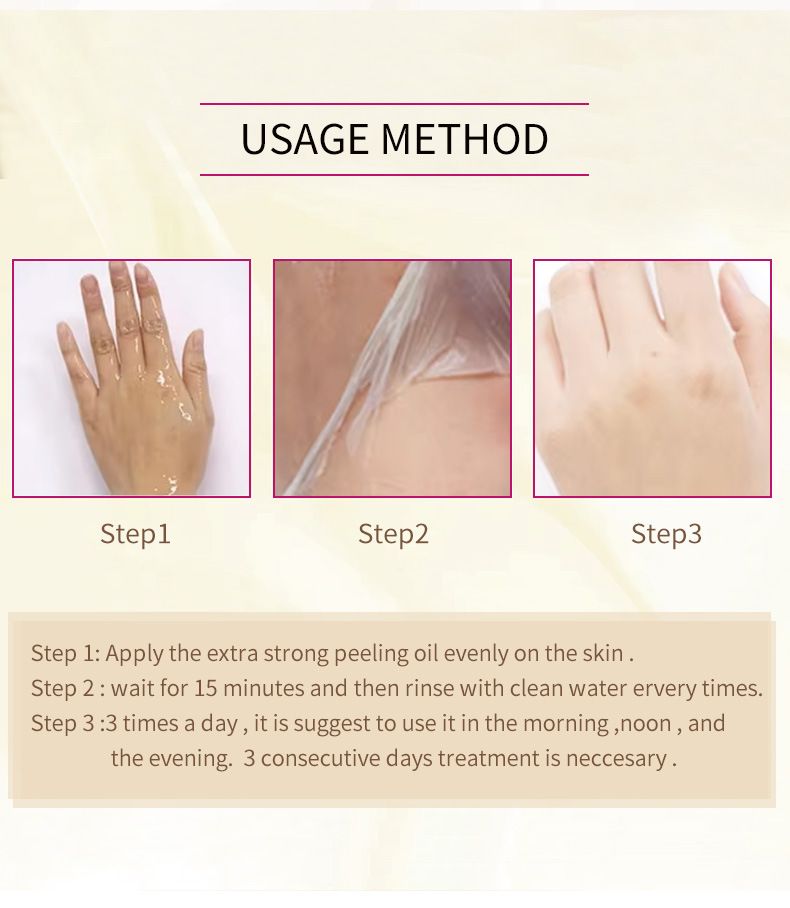 Voetverzorging Engelse Peeling Olie voor Handen en Voeten EXTRA STERKE PEELINGOLIE_voghion.com
