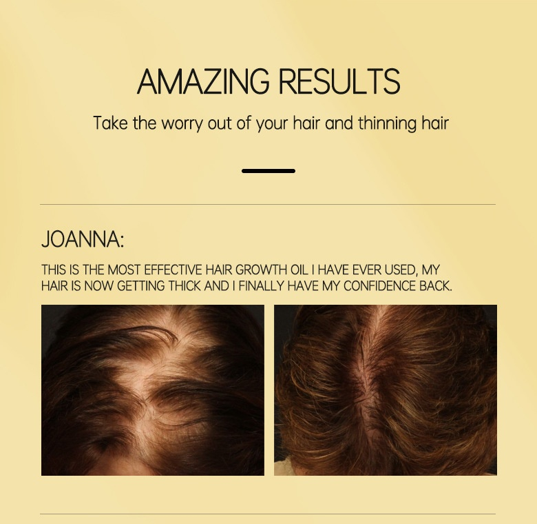Hairinque fluffy long conserved essential oil growth hair care scalp nutrition ball essay_voghion.com