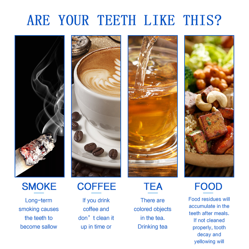 Whitening Jayswing Tand essentie Mondreiniging & Tand Reparatie & Vlekverwijderaar Tand Vergeling & Tandsteen Zorg Reiniging &_voghion.com