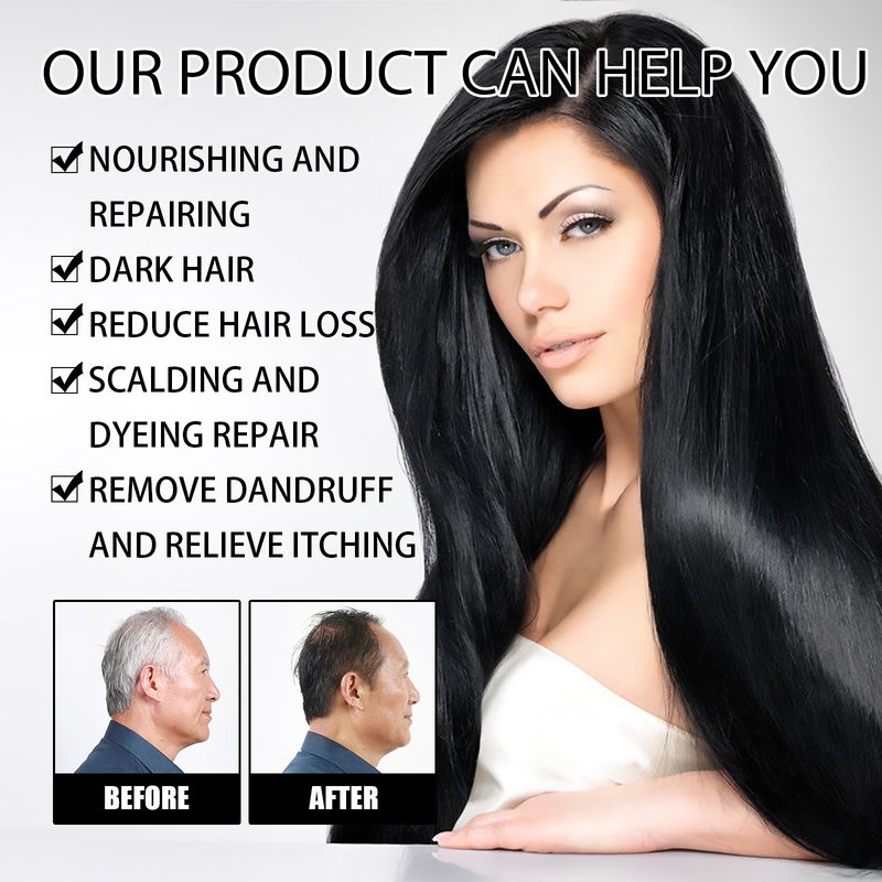Polygonum multiflorum white to black shampoo deeply repairs, hair, removes dandruff, relieves itching, 2024 popular_voghion.com