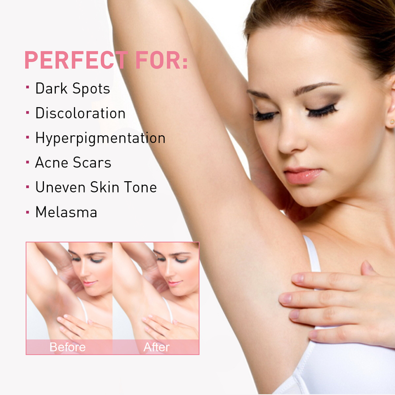 Niacinamide Whitening Cream reduces dullness, underarm, elbow joint blackness, even skin tone, and_voghion.com