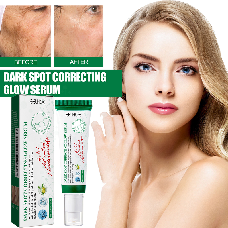 EELHOE verblassen flecken und brighten essence verschönern haut, sommersprossen, melanin reparatur, stumpfe haut pflege_voghion.com