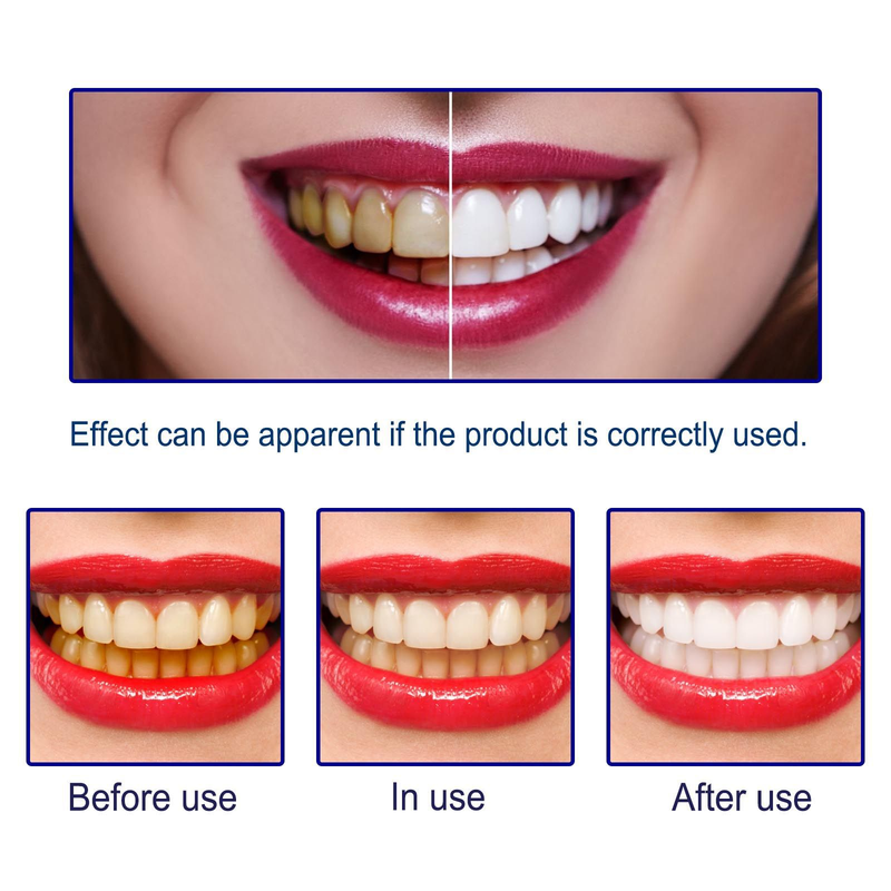 essence, tooth Tooth spot cleaning, tooth care, essence, tooth stain cleaning, yellow stain, tooth stain, fresh bre _voghion.com